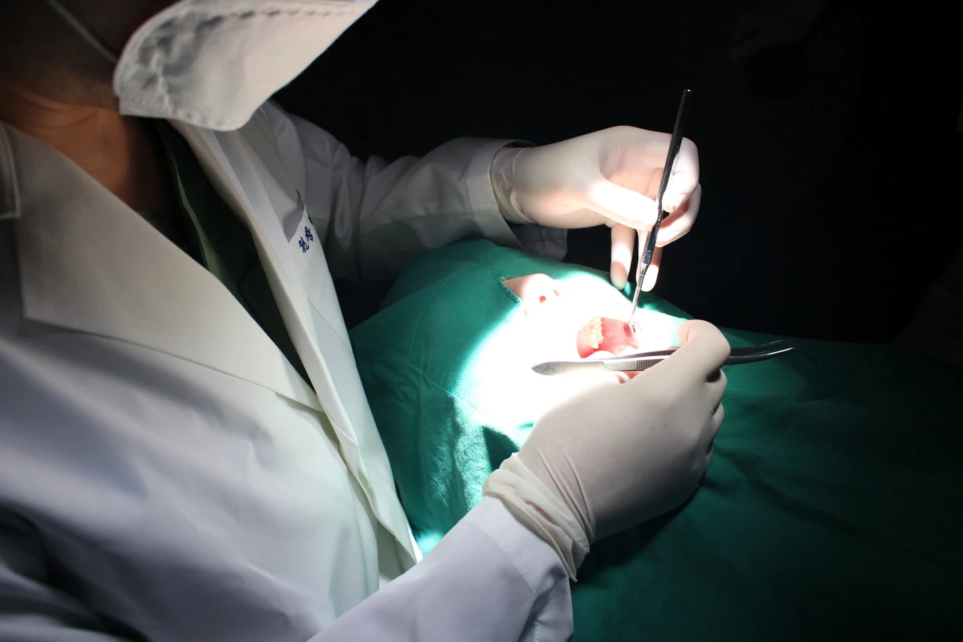 무영등 아래에서 기구를 들고 발치를 진행하는 손의 근접 사진.